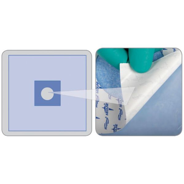 Picture of Drape, Sterile Invisi-shield 16" x 16" with 2.5" Adhesive Aperture - 40/Case